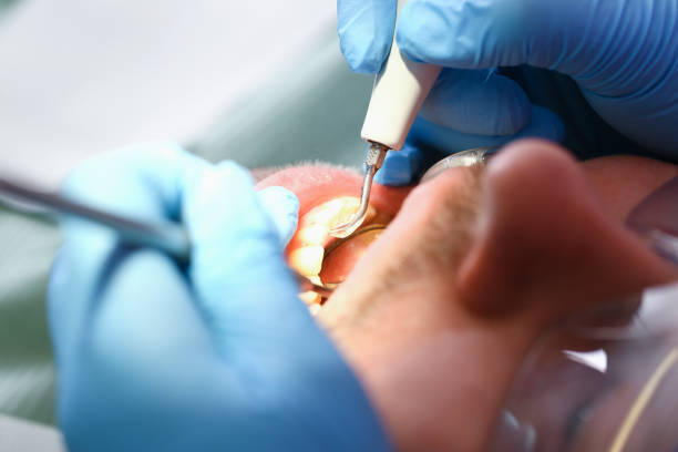 Best Mobile Emergency Dentist in Venus, TX