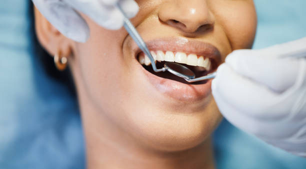 Best Emergency Dentist for Knocked-Out Tooth in Venus, TX