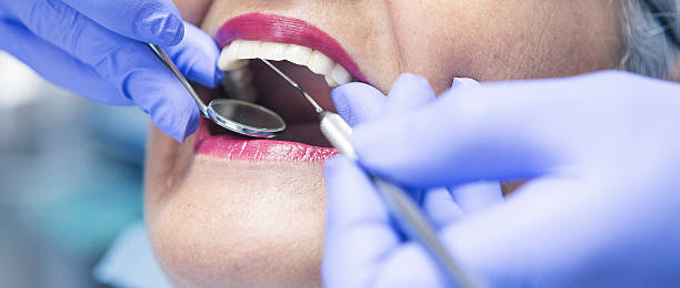 Best Emergency Dental Services for Seniors in Venus, TX